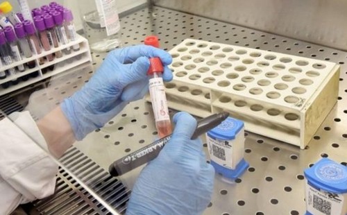 Teste da Unesp identifica assintomáticos de covid-19 pela saliva