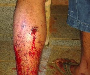 Homem é baleado com dois tiros durante discussão em bar em Jeremoabo- BA