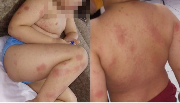 Paulo Afonso: mãe relata drama e faz alerta para sintomas em crianças após filho de 3 anos contrair covid-19