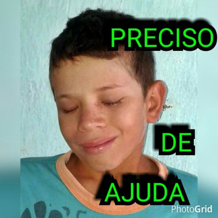 UAUÁ-BA: MENINO DE 11 ANOS PRECISA URGENTEMENTE DE SUA AJUDA; VEJA COMO AJUDÁ-LO