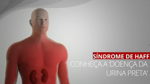 Bahia registra um aumento de casos da “Urina Preta”, Doença de Haff; confira orientações sobre a doença