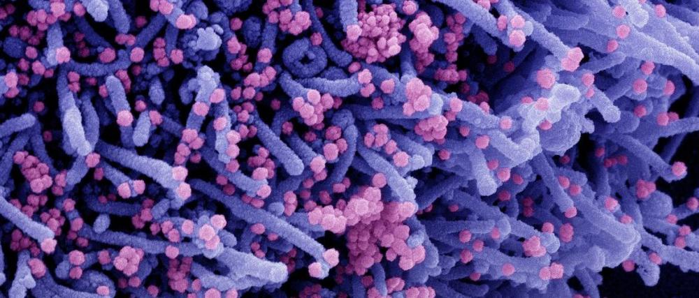 Alerta: casos de Covid-19 disparam pelo mundo e já se cogita volta das medidas restritivas