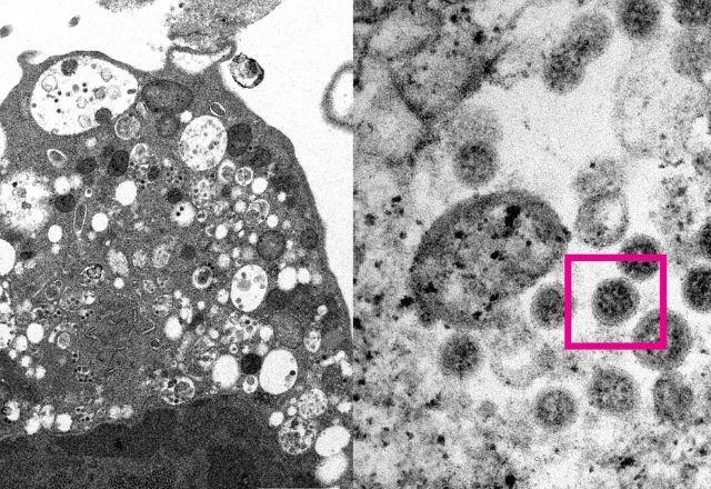 Ômicron é variante que sobrevive por mais tempo na pele e em plásticos, mostra estudo