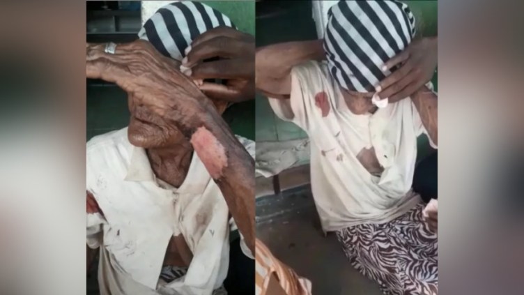 Idosa de 103 anos é espancada durante assalto na Bahia