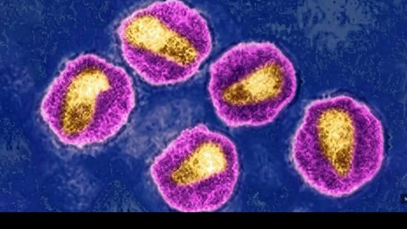 Descoberta de variante mais agressiva do HIV traz novas implicações sobre o tema