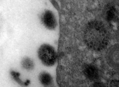Março teve o menor nº de casos de SRAG e internações por Influenza chegaram a zer