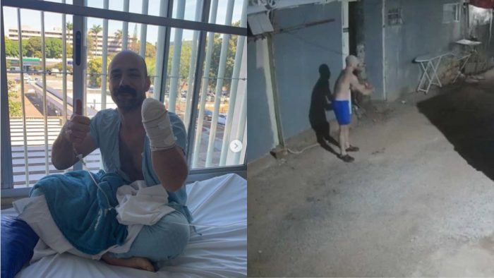 PM tem mão decepada ao tentar defender mulher de agressor