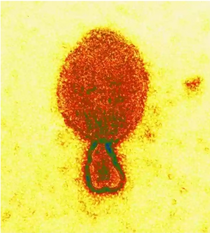 Cientistas chineses fizeram um alerta sobre a identificação de um novo vírus no país.