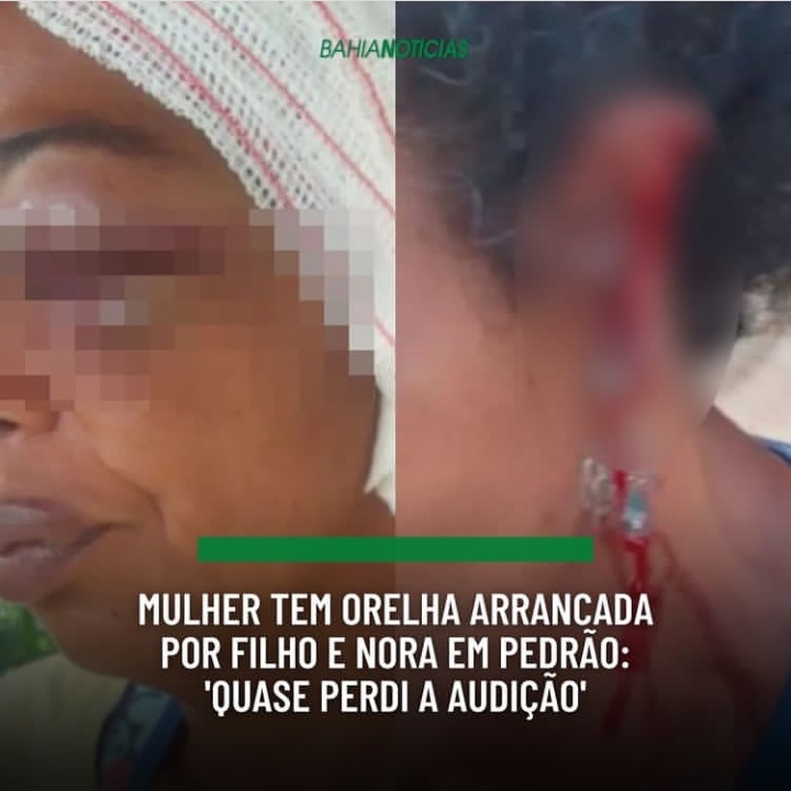 Uma mulher identificada foi agredida e teve a orelha arrancada pelo filho e pela nora.