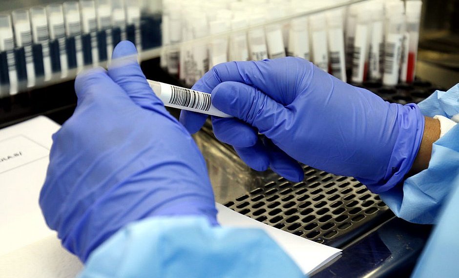 Estado registra 679 casos de Covid-19 e mais 11 óbitos