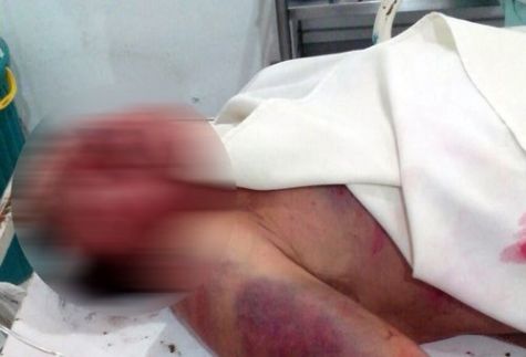 QUIJINGUE-BA: IDOSO É AMARRADO E ESPANCADO APÓS SER FLAGRADO VIOLENTANDO 'BURRA' DO VIZINHO