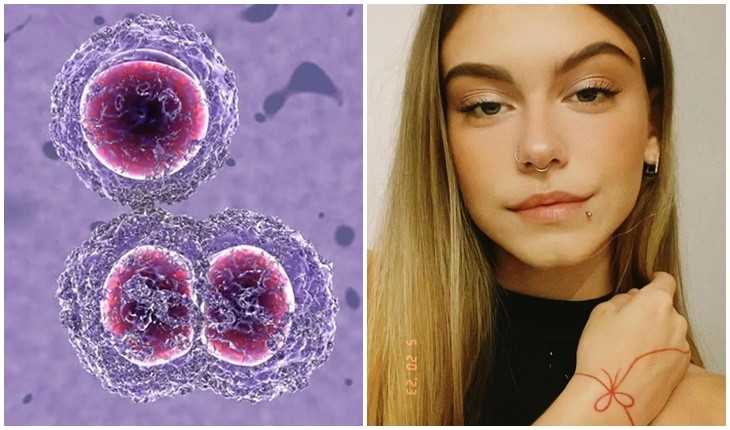 Entenda o que é a Staphylococcus aureus, bactéria que matou jovem após espremer a espinha